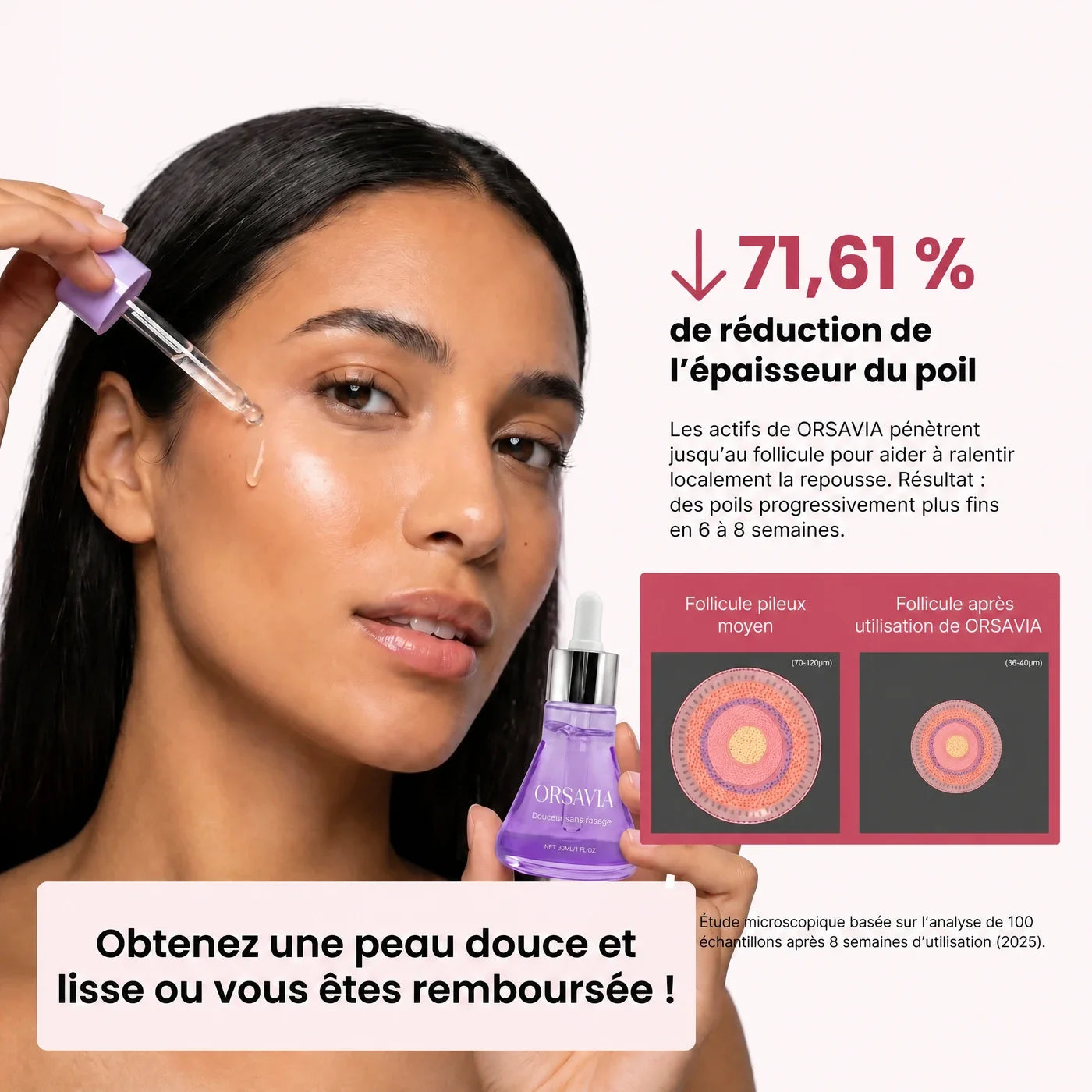 71,61 % de réduction de l'épaisseur du poil