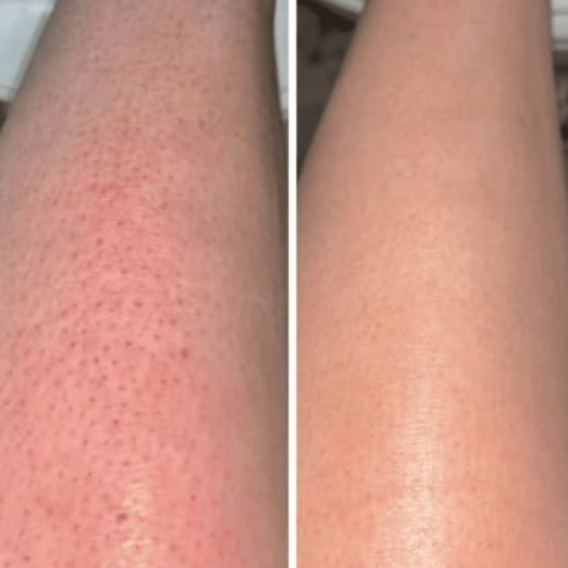 Jambes